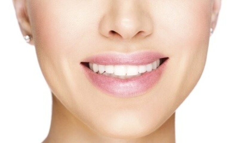 1, 2, or 4 Porcelain Crowns with X-Ray and Exam from Dr. Mark Hagopian at Somerset Dental Group (Up to 42% Off)