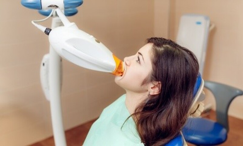 Up to 69% Off on Teeth Whitening - In-Office - Branded (Beyond, Power) at Planet Tan