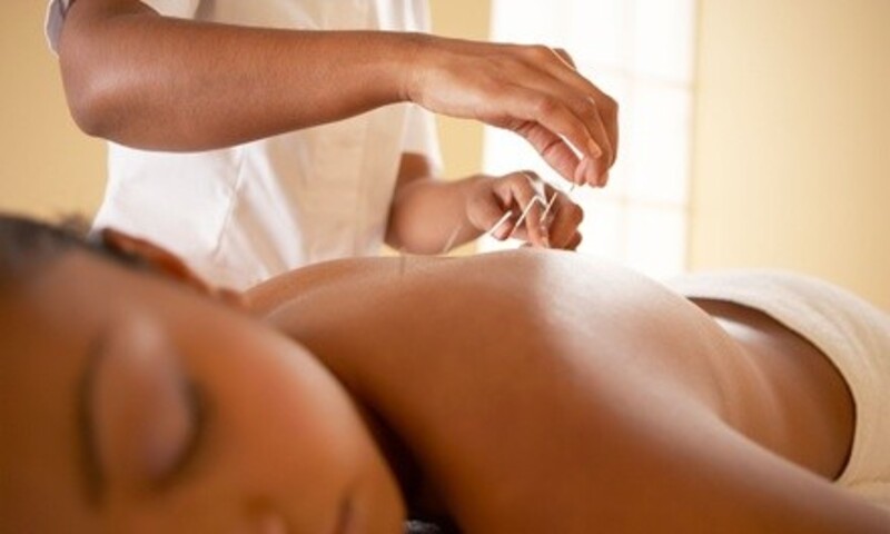One Acupuncture and Optional Therapy Session at Lifeline Center (Up to 41% Off)