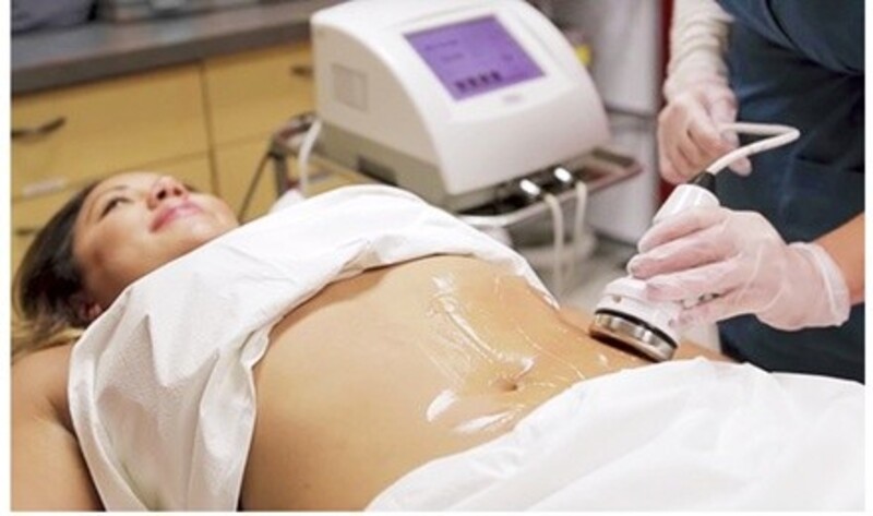 Up to 82% Off on Liposuction - Non-Invasive Laser (iLipo) at Ja’Lis Esthètique