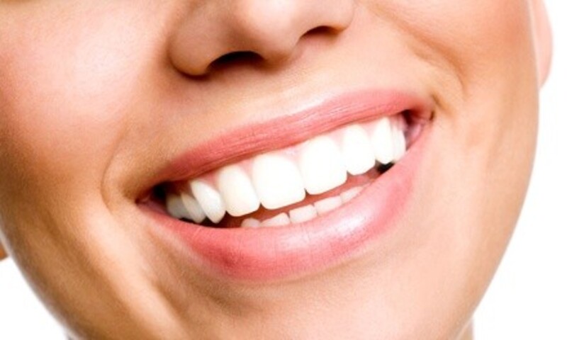 Zoom! Teeth Whitening or Dental Exam with Whitening Package at Brite Clean Smiles (Up to 60% Off)