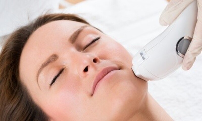 Up to 29% Off on Electrolysis at Ricochet's Electrology