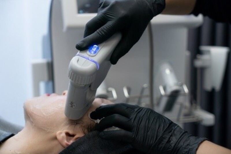 Up to 58% Off on Radio Frequency Skin Tightening at Timeless beauty