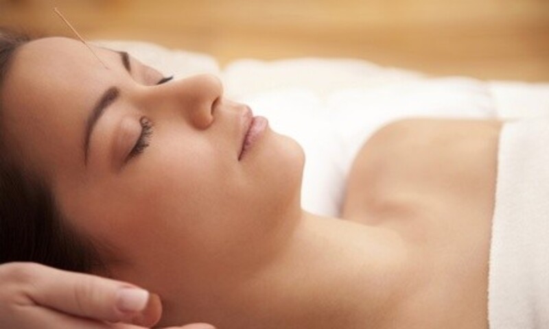 Up to 64% Off on Acupuncture Services at Wellman Acupuncture