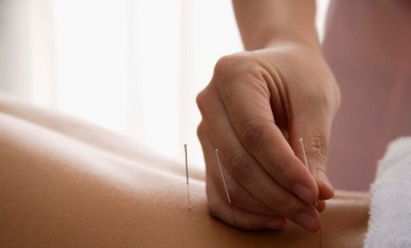 Up to 68% Off on Acupuncture Services at Oriental Acupuncture Health Center