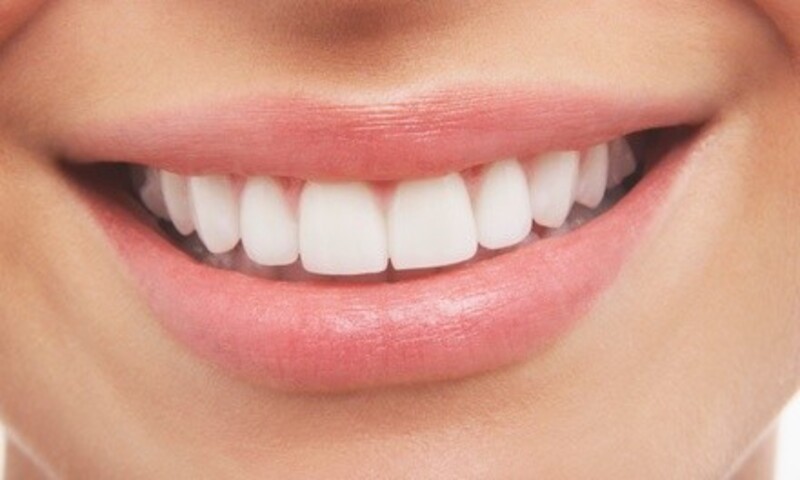 30-Minute Express Teeth Whitening for One Person at Bright White Express (Up to 59% Off)