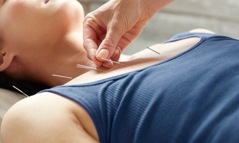 One Consultation and Acupuncture or Muscle Release Therapy Session at Animus Acutherapy (Up to 50% Off)
