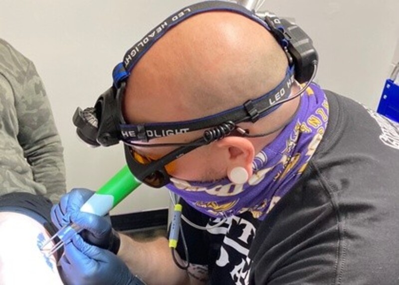 Up to 70% Off on Tattoo Removal at Creative Re-Imaging