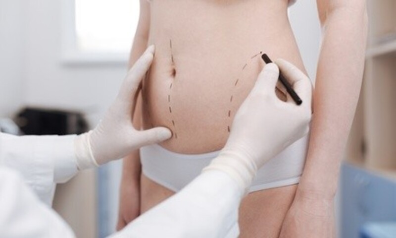 Up to 35% Off on Liposuction - Invasive Laser - Smart Lipo at Siloette Therapy