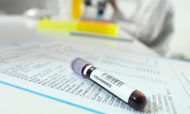 Up to 49% Off on Blood Testing at Lonestar Lab Testing