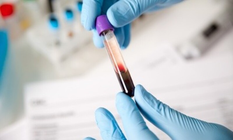 Deal for Phlebotomy Training Institute