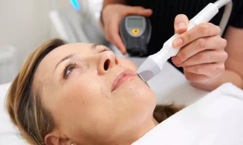 One or Six Laser-Hair Removal on Small, Medium, Large, or X-Large Area at Radiant Aesthetics (Up to 83% Off)