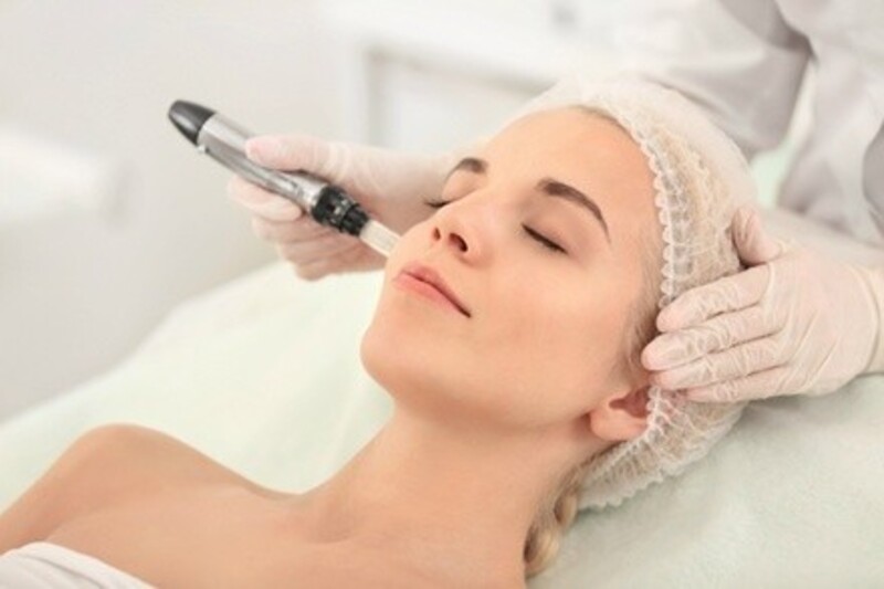 Up to 79% Off on Micro-Needling at Aromas Therapy