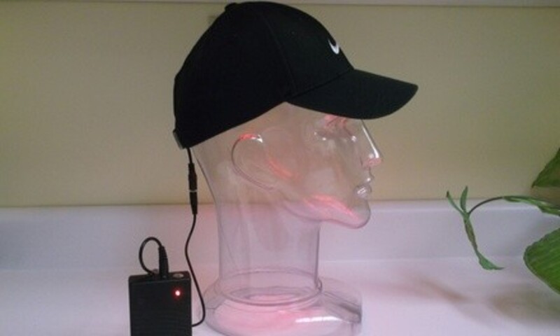 Microscopic Scalp Exam and Portable Laser Hat at Hair & Scalp Clinic (Up to 56% Off)