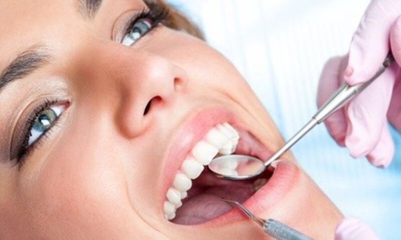 Up to 59% Off on Teeth Whitening - In-Office - Branded (Beyond, Power) at Let it Freeze
