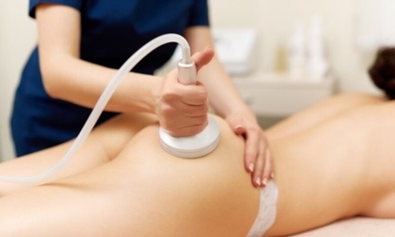Cavitation or Laser Lipo w/ Radio-Frequency Facials at GetSculptedBy Lori (Up to 30% Off). 3 Options Available.