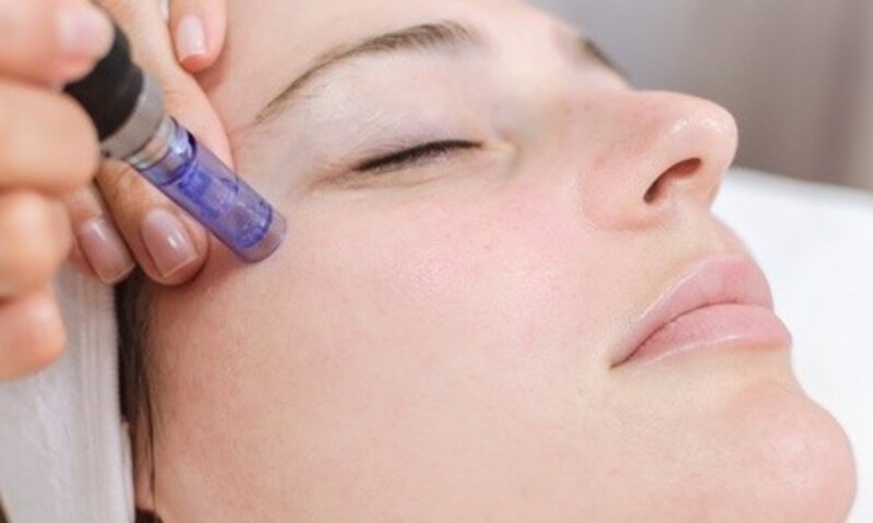 Deal for LNL Skin Care