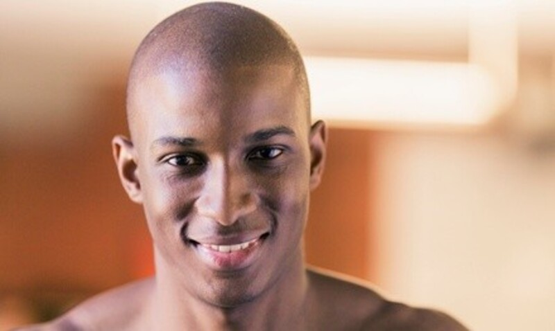 Scalp Micropigmentation Session at Hair Extension Specialist (Up to 50% Off). Three Options Available.