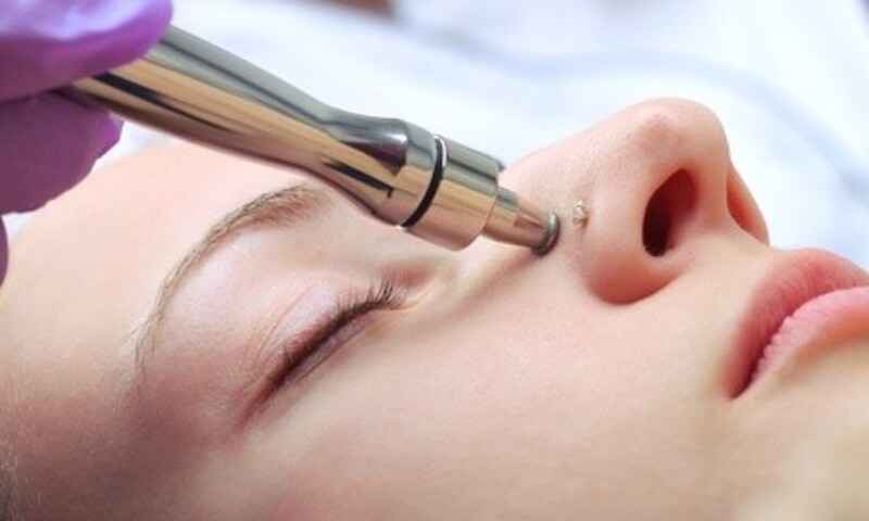 Up to 38% Off on Microdermabrasion at Heather at Elliot st. Salon