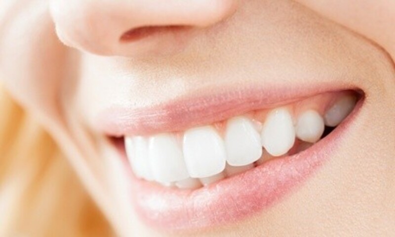 Up to 61% Off on Teeth Whitening at Tuynke Spa