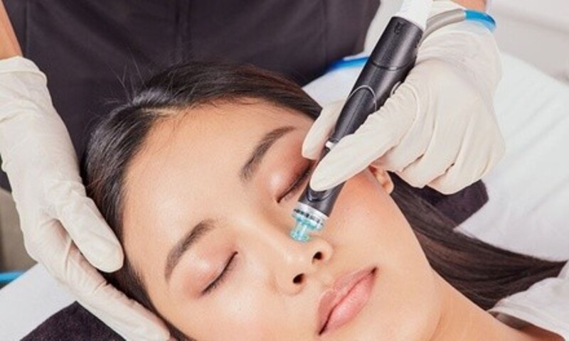 Deal for Skinlicious Laser & Aesthetics