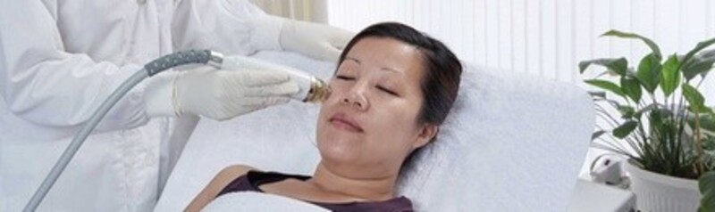 Up to 56% Off on Radio Frequency Microneedling at Essential Skin Care